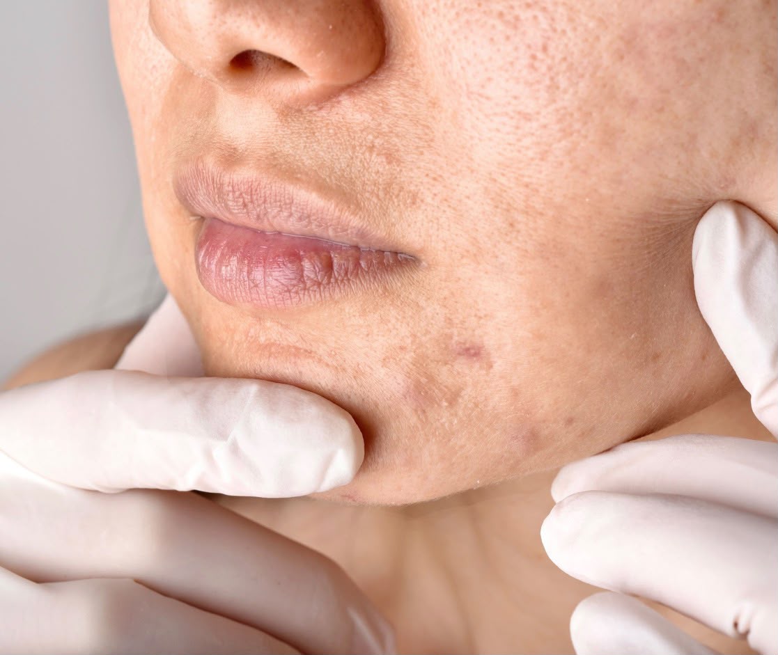 Sherbimet e ofruara nga Departamenti i Dermatologjise
